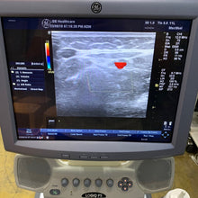 Load image into Gallery viewer, Used GE Logiq P5 Ultrasound Unit with Linear Probe Convex Probe Medical Equipment