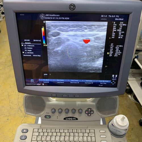 Used GE Logiq P5 Ultrasound Unit with Linear Probe Convex Probe Medical Equipment