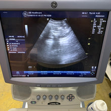 Load image into Gallery viewer, Used GE Logiq P5 Ultrasound Unit with Linear Probe Convex Probe Medical Equipment