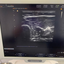Load image into Gallery viewer, Used 3D 4D Ultrasound Medison Sonoace X8 With Convex C2-5EL Linear L5-12EC Ultrasound