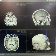 Load image into Gallery viewer, Used Stryker Navigation System