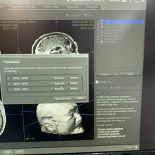 Load image into Gallery viewer, Used Stryker Navigation System