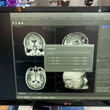 Load image into Gallery viewer, Used Stryker Navigation System