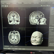 Load image into Gallery viewer, Worldwide Shipped 1,300$ Used Stryker Navigation System Medical Equipment
