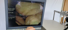 Load image into Gallery viewer, Used Olympus Gif-Q260J 9.2mm Gastroscope For Endoscopy