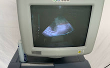 Load image into Gallery viewer, medison p2-4ac cardiac probe