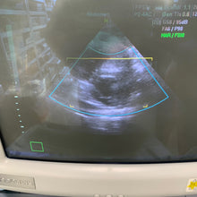 Load image into Gallery viewer, Worldwide Shipped 2,400$ Used Medison Accuvix XQ 3D Ultrasound With Cardiac Linear Convex 3Probes
