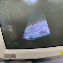 Load image into Gallery viewer, Used Medison Accuvix XQ 3D Ultrasound With 3Probes