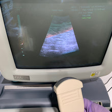 Load image into Gallery viewer, Used Medison Accuvix XQ 3D Ultrasound With 3Probes