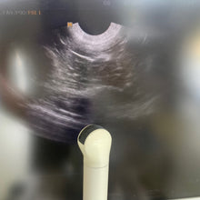 Load image into Gallery viewer, Used Medison Accuvix V10 Ultrasound with Convex Vaginal Probes