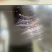 Load image into Gallery viewer, Used Medison Accuvix V10 Ultrasound with Convex Vaginal Probes