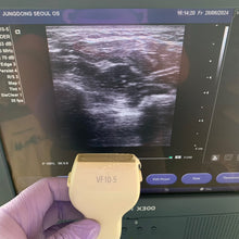 Load image into Gallery viewer, Used Siemens Acuson X300 Ultrasound With Linear Probe