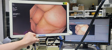 Load image into Gallery viewer, Used Olympus GIF H170 Gastroscope 9.2mm Endoscope