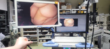Load image into Gallery viewer, Used Olympus CV170 GIF H170 Gastroscope Full Endoscope System