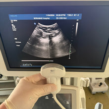 Load image into Gallery viewer, Used Philips IU22 Ultrasound Unit Convex Linear Linear 3Probes