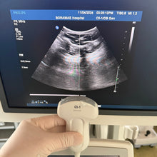 Load image into Gallery viewer, Used Philips IU22 Ultrasound Unit Convex Linear Linear 3Probes