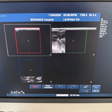 Load image into Gallery viewer, Used Philips IU22 Ultrasound Unit Convex Linear Linear 3Probes