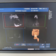 Load image into Gallery viewer, Used Philips IU22 Ultrasound Unit Convex Linear Linear 3Probes