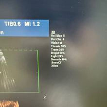 Load image into Gallery viewer, Used Philips IU22 Ultrasound Unit Convex Linear Linear 3Probes