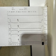 Load image into Gallery viewer, Used Nihon Kohden Cardiofax S EKG ECG