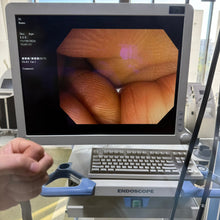 Load image into Gallery viewer, Used Olympus CV170 GIF H170 Gastroscope Full Endoscope System