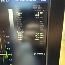 Load image into Gallery viewer, Used GE Vivid E9 XDclear 4D Ultrasound Unit with 3Probes