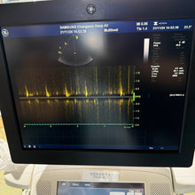 Load image into Gallery viewer, Used GE Vivid E9 XDclear 4D Ultrasound Unit with 3Probes