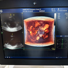 Load image into Gallery viewer, Used GE Vivid E9 XDclear 4D Ultrasound Unit with 3Probes