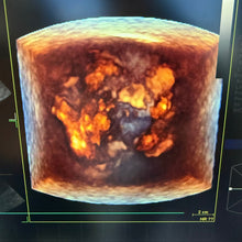 Load image into Gallery viewer, Used GE Vivid E9 XDclear 4D Ultrasound Unit with 3Probes