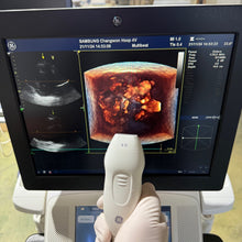 Load image into Gallery viewer, Used GE Vivid E9 XDclear 4D Ultrasound Unit with 3Probes