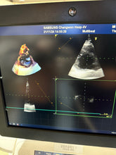 Load image into Gallery viewer, Used GE Vivid E9 XDclear 4D Ultrasound Unit with 3Probes