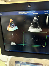 Load image into Gallery viewer, Used GE Vivid E9 XDclear 4D Ultrasound Unit with 3Probes