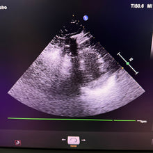 Load image into Gallery viewer, Used Philips Affiniti 50G Cardiac Convex Linear 3 Probes Ultrasound
