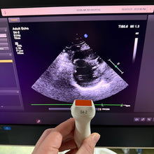 Load image into Gallery viewer, Used Philips Affiniti 50G Cardiac Convex Linear 3 Probes Ultrasound