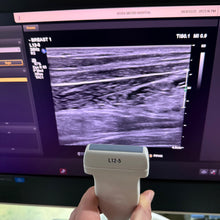Load image into Gallery viewer, Used Philips Affiniti 50G Cardiac Convex Linear 3 Probes Ultrasound