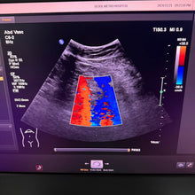 Load image into Gallery viewer, Used Philips Affiniti 50G Cardiac Convex Linear 3 Probes Ultrasound
