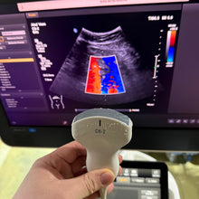 Load image into Gallery viewer, Used Philips Affiniti 50G Cardiac Convex Linear 3 Probes Ultrasound