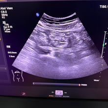 Load image into Gallery viewer, Used Philips Affiniti 50G Cardiac Convex Linear 3 Probes Ultrasound
