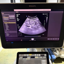 Load image into Gallery viewer, Used Philips Affiniti 50G Cardiac Convex Linear 3 Probes Ultrasound