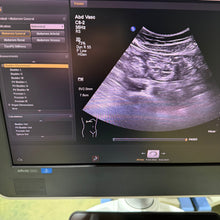 Load image into Gallery viewer, Used Philips Affiniti 50G Cardiac Convex Linear 3 Probes Ultrasound