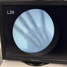 Load image into Gallery viewer, Genoray Zen2060 C arm Xray