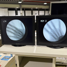 Load image into Gallery viewer, Genoray Zen2060 C arm Xray