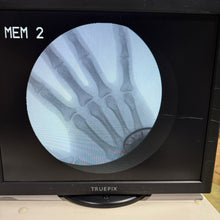 Load image into Gallery viewer, Genoray Zen2060 C arm Xray