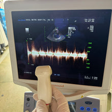 Load image into Gallery viewer, Used Aloka Prosound Alpha7 Ultrasound with Convex Cardiac Linear 3 Probes Transducer