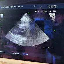 Load image into Gallery viewer, Used Aloka Prosound Alpha7 Ultrasound with Convex Cardiac Linear 3 Probes Transducer