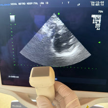 Load image into Gallery viewer, Used Aloka Prosound Alpha7 Ultrasound with Convex Cardiac Linear 3 Probes Transducer