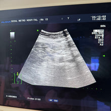 Load image into Gallery viewer, Used Aloka Prosound Alpha7 Ultrasound with Convex Cardiac Linear 3 Probes Transducer