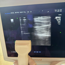 Load image into Gallery viewer, Used Aloka Prosound Alpha7 Ultrasound with Convex Cardiac Linear 3 Probes Transducer