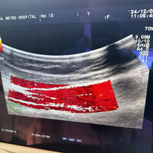Load image into Gallery viewer, Used Aloka Prosound Alpha7 Ultrasound with Convex Cardiac Linear 3 Probes Transducer