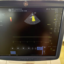 Load image into Gallery viewer, Used GE Logiq E9 Ultrasound with 3Probes L8 18i & 9L & M4S